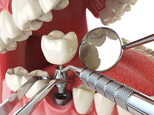 Best Emergency Dentist for Lost Fillings or Crowns in Atkins, AR